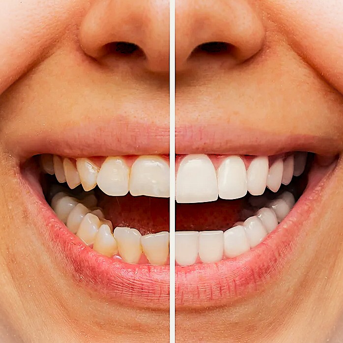 Smile with confidence!