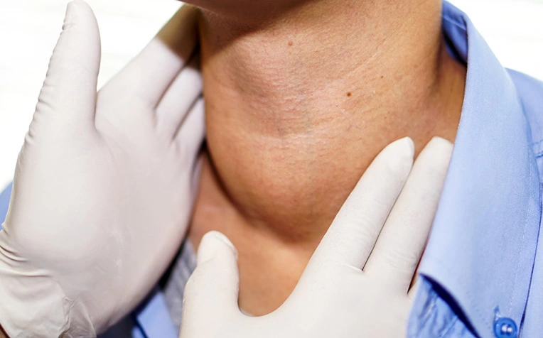 Non-Hodgkin Lymphoma